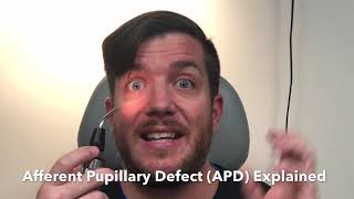 Afferent Pupillary Defect  APD Explained [upl. by Neona]