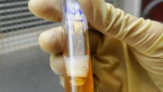 Triple SugarIron Agar Test  Amrita University [upl. by Eerahs]