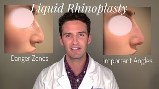 Liquid Rhinoplasty Everything you need to know [upl. by Oimetra]