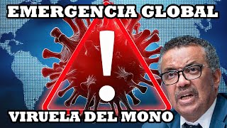 ¡Alerta Global La OMS Declara Emergencia Sanitaria por Viruela del Mono Todo lo que Debes Saber [upl. by Erwin]