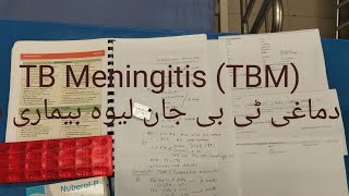 Tuberculous Meningitis TBM CF amp managment دماغی ٹی بی جان لیوہ بیماری ہے [upl. by Alisen]