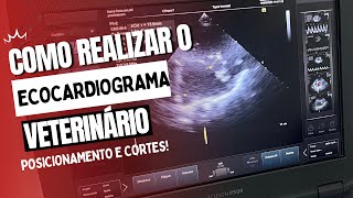 COMO REALIZAR ECOCARDIOGRAMA  Entenda o posicionamento para o exame e os cortes ecocardiográficos [upl. by Irodim]