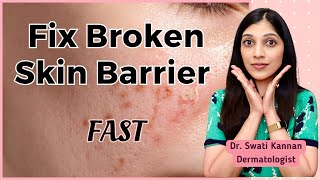 Fix Your Broken Skin Barrier Fast Proven Dermatologist Secrets [upl. by Aketahs]