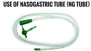 Use of nasogastric tube NG tube by Kshitij Foundation Chhindwara [upl. by Bianchi]