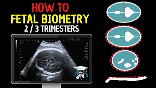 How to Perform Fetal Biometry in the Second and Third Trimesters  Practical Guide [upl. by Betthezel186]