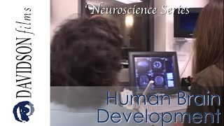 Human Brain Development Nature and Nurture a preview Davidson Films [upl. by Giliane8]