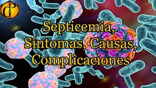 Septicemia Síntomas Causas Complicaciones [upl. by Euqor]