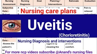 Uveitis nursing care plansChorioretinitis nursing care plans [upl. by Asusej]