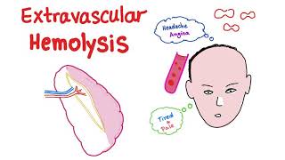 Extravascular Hemolysis [upl. by Ynavoj170]