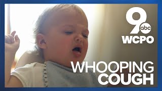 Sound of whooping cough [upl. by Rainah777]