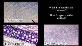 Cartilage  Function and Location with Quiz [upl. by Ilek]