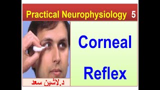 Corneal reflexLashin دلاشين [upl. by Mcwherter]