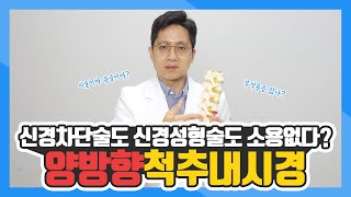 양방향 척추 내시경 수술이란 ｜신경차단술신경성형술 다 소용없었어요 [upl. by Nalyr]