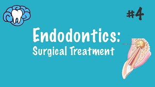 Endodontics  Surgical Treatment  INBDE ADAT [upl. by Casilde546]