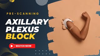 Axillary brachial plexus block  Pre Scanning Identifying the individual nerves [upl. by Scales]