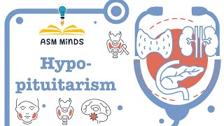 HypoPituitarism by ASM Minds [upl. by Sander]