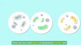 Understanding Episiotomy [upl. by Nona857]