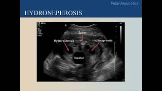 Ultrasound Training Course 17 part 2 [upl. by Arukas820]