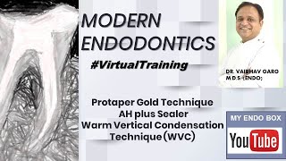 Warm Vertical Condensation Obturation technique WVC obturation [upl. by Ynnaj]