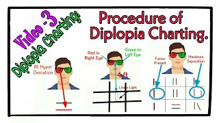 Procedure of Diplopia Charting Diplopia Charting Video3 [upl. by Susej]