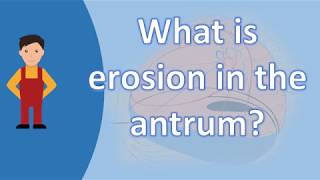 What is erosion in the antrum   Best and Top Health FAQs [upl. by Alderson]