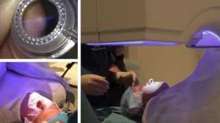 London Vision Clinic  LASIK  Live laser eye surgery  Professor Dan Reinstein [upl. by Sivet126]