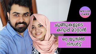 ചുണ്ടിലെ കറുപ്പ് നിറം മാറ്റി ഭംഗി ആക്കാൻ  My Lips Care  Lips Care Tips Malayalam [upl. by Enoid]