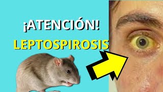 LEPTOSPIROSIS😱✅ Fisiopatología signos y síntomas diagnóstico y tratamiento MUY FÁCIL 😱 [upl. by Bow]