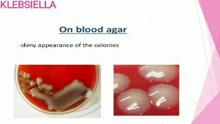 Gram Negative Rods Pathogens outside the enteric tract [upl. by Elagibba369]