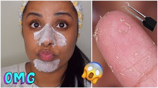 DIY Pore Strips Get Rid of BlackheadsWhiteheads  EASY [upl. by Ahsieki930]