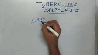 Tuberculous Salphingitis [upl. by Melisande]