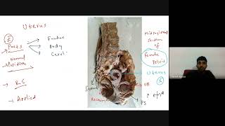 Abdomen  Spotters  Part 3  1st Year MBBS  Dr Dhinesh Kumar  AIIMS  mbbs anatomy [upl. by Anitsuga]