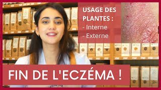 CE QUON NE VOUS DIRA PAS SUR LECZÉMA  solution interne peau démangeaisons plantes huiles [upl. by Padriac]