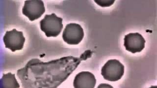 globule blanc attaque une bacterie m1 [upl. by Negam]