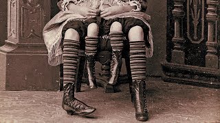 The Story Of Myrtle Corbin The Real Four Legged Girl [upl. by Eteragram]