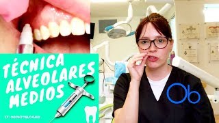 Técnica Alveolares Medios 💉 [upl. by Asil]