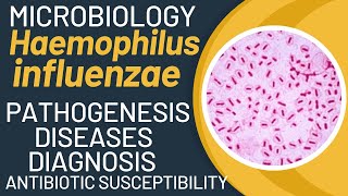 Haemophilus influenzae microbiology  Haemophilus influenzae pathogenesis [upl. by Jocelyn462]