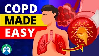 COPD Made Easy  Types Causes Symptoms and Treatment [upl. by Helfant]