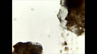 Demodex  killing in seconds with ethanol [upl. by Amikan213]