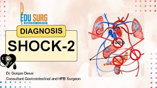 Want to Master Shock diagnosis Watch This Now  types of shock  Part 2 [upl. by Hirz355]