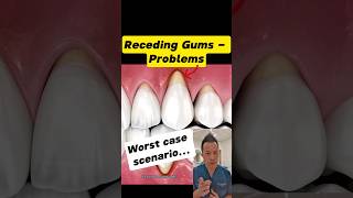 Why Receding Gums Are a Bigger Problem Than You Think dentallan dentist shorts [upl. by Ronnica]