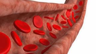 Difference Between Arteriosclerosis and Atherosclerosis [upl. by Daphie456]