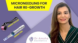 Microneedling for Hair Loss  Does It Works  डर्मा रोलर से बाल उगने के फायदे  Dr Amoha Bhatia [upl. by Yelrehs418]