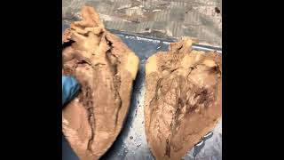 sheep heart dissection [upl. by Havens]