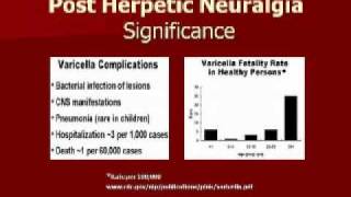 Pain Didactic Herpes Zoster and PHN  Pt 3 [upl. by Enaira]