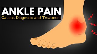 Ankle Pain Survival Guide Walking Comfortably Through Causes and Treatments [upl. by Nawaj]