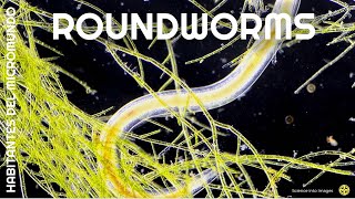 Roundworms  HABITANTES DEL MICROMUNDO [upl. by Aniwde]