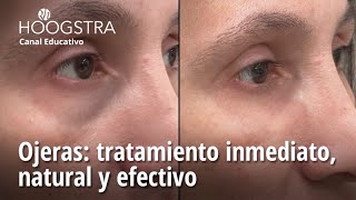 Ojeras tratamiento inmediato natural y efectivo  24130 [upl. by Grand]