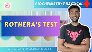 Rotheras Test URINE TEST FOR KETONE BODIES  BIOCHEMISTRY PRACTICAL with viva questions [upl. by Erised158]