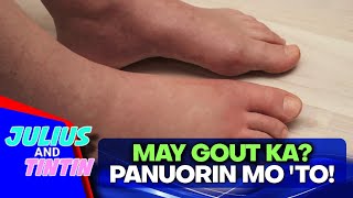 Gout sintomas sanhi gamutan risk factors [upl. by Anitnuahs621]